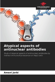 Paperback Atypical aspects of antinuclear antibodies Book