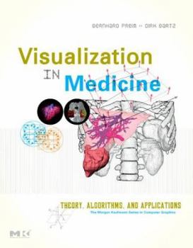 Visualization in Medicine: Theory, Algorithms, and Applications (The Morgan Kaufmann Series in Computer Graphics) (The Morgan Kaufmann Series in Computer Graphics)