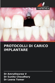 Paperback Protocolli Di Carico Implantare [Italian] Book