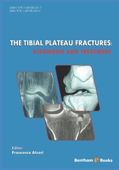 Paperback The Tibial Plateau Fractures: Diagnosis and Treatmment Book