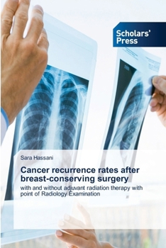 Paperback Cancer recurrence rates after breast-conserving surgery Book