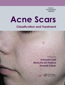 Paperback Acne Scars: Classification and Treatment Book