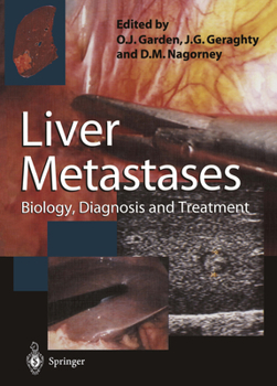 Paperback Liver Metastases: Biology, Diagnosis and Treatment Book