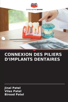 Connexion Des Piliers d'Implants Dentaires (French Edition)