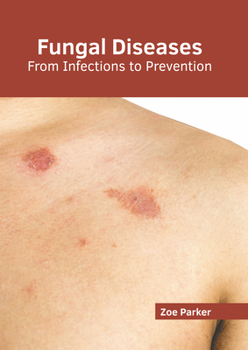 Hardcover Fungal Diseases: From Infections to Prevention Book