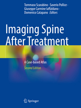 Paperback Imaging Spine After Treatment: A Case-Based Atlas Book