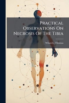 Practical Observations of the Tibia: To Which Is Which a Defence of a Tract, Entitled, Description Of; Illustrated with Cases, and a Copper-Plate (Classic Reprint)