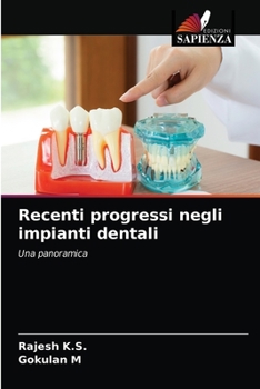 Paperback Recenti progressi negli impianti dentali [Italian] Book