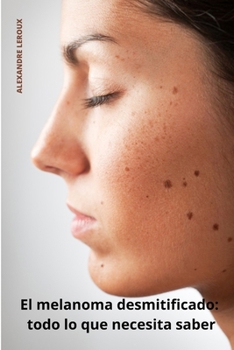 Paperback El melanoma desmitificado: todo lo que necesita saber [Spanish] Book