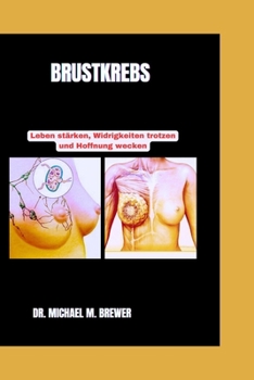 BRUSTKREBS: Leben Stärken, Widrigkeiten trotzen und Hoffnung Wecken (Staying Healthy and Hope for Better Tomorrow Series) (German Edition)