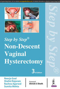 Paperback Step by Step: Non-Descent Vaginal Hysterectomy Book