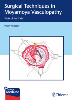 Hardcover Surgical Techniques in Moyamoya Vasculopathy: Tricks of the Trade Book