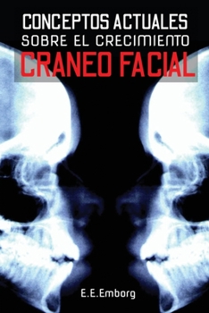 Paperback Conceptos Actuales Sobre El Crecimiento Cráneo-Facial [Spanish] Book