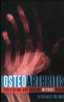 Paperback Osteoarthritis: Preventing and Healing Without Drugs Book