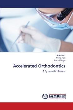 Paperback Accelerated Orthodontics Book