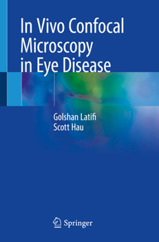 Paperback In Vivo Confocal Microscopy in Eye Disease Book