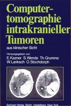Computed Tomography in Intracranial Tumors: Differential Diagnosis and Clinical Aspects