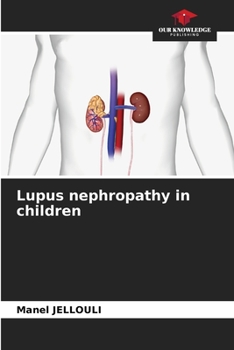 Paperback Lupus nephropathy in children Book