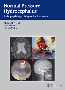 Hardcover Normal Pressure Hydrocephalus: Pathophysiology - Diagnosis - Treatment Book