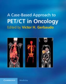 Paperback A Case-Based Approach to Pet/CT in Oncology Book