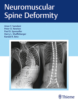 Hardcover Neuromuscular Spine Deformity Book