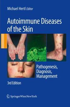 Hardcover Autoimmune Diseases of the Skin: Pathogenesis, Diagnosis, Management Book