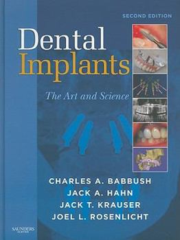Hardcover Dental Implants: The Art and Science Book