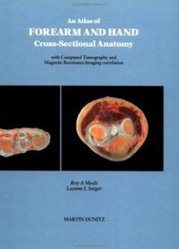 Hardcover An Atlas of Forearm and Hand Cross-Sectional Anatomy with CT and MRI Correlation Book