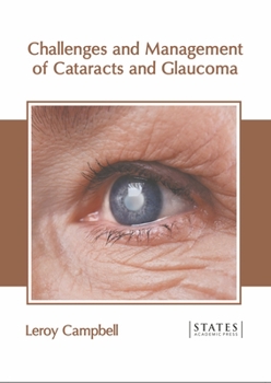 Hardcover Challenges and Management of Cataracts and Glaucoma Book