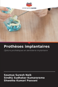 Paperback Prothèses implantaires [French] Book