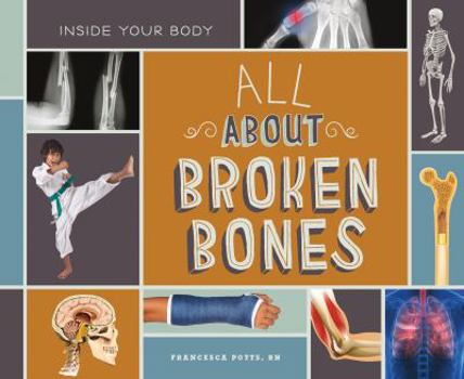 All about Broken Bones - Book  of the Inside Your Body