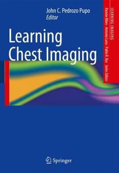 Paperback Learning Chest Imaging Book