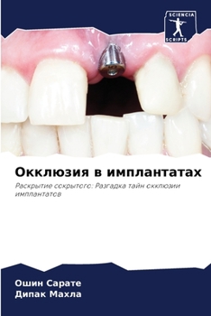 Paperback Окклюзия в имплантатах [Russian] Book