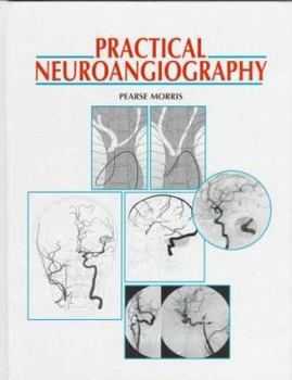 Paperback Practical Neuroangiography Book