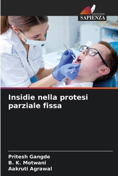 Paperback Insidie nella protesi parziale fissa [Italian] Book