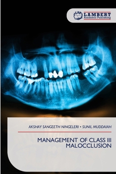 Management of Class III Malocclusion