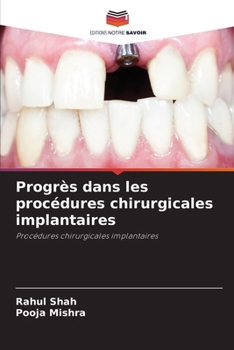 Progrès dans les procédures chirurgicales implantaires: Procédures chirurgicales implantaires