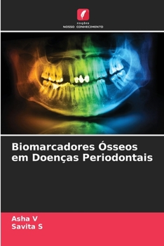 Paperback Biomarcadores Ósseos em Doenças Periodontais [Portuguese] Book