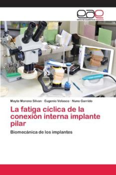 Paperback La fatiga cíclica de la conexión interna implante pilar [Spanish] Book