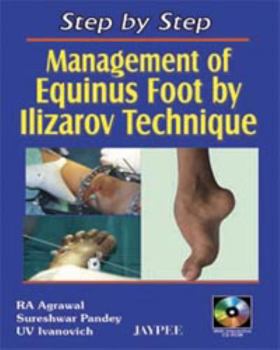 Hardcover Step by Step: Management of Equinus Foot by Ilizarov Technique Book