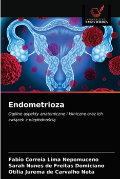 Paperback Endometrioza [Polish] Book