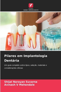 Paperback Pilares em Implantologia Dentária [Portuguese] Book
