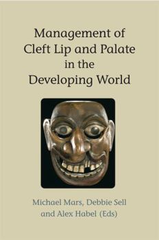 Paperback Management of Cleft Lip and Palate in the Developing World Book