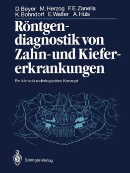 Paperback Röntgendiagnostik Von Zahn- Und Kiefererkrankungen: Ein Klinisch-Radiologisches Konzept [German] Book