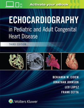 Hardcover Echocardiography in Pediatric and Adult Congenital Heart Disease Book