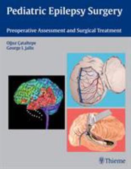 Hardcover Pediatric Epilepsy Surgery: Preoperative Assessment and Surgical Treatment Book