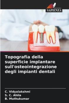 Topografia della superficie implantare sull'osteointegrazione degli impianti dentali (Italian Edition)