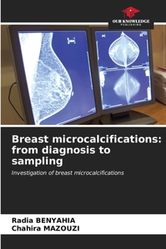 Breast microcalcifications: from diagnosis to sampling: Investigation of breast microcalcifications