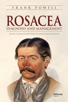 Hardcover Rosacea: Diagnosis and Management Book