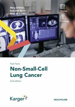 Paperback Fast Facts: Non-Small-Cell Lung Cancer Book